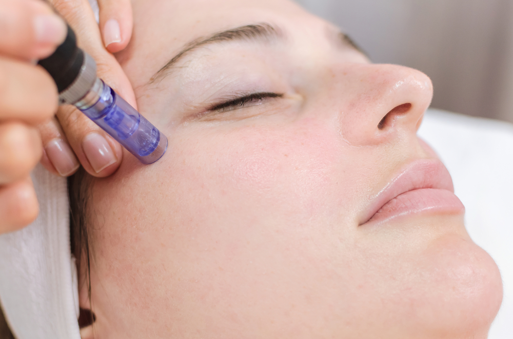 How long does it take to see results from micro needling 637462958972072667