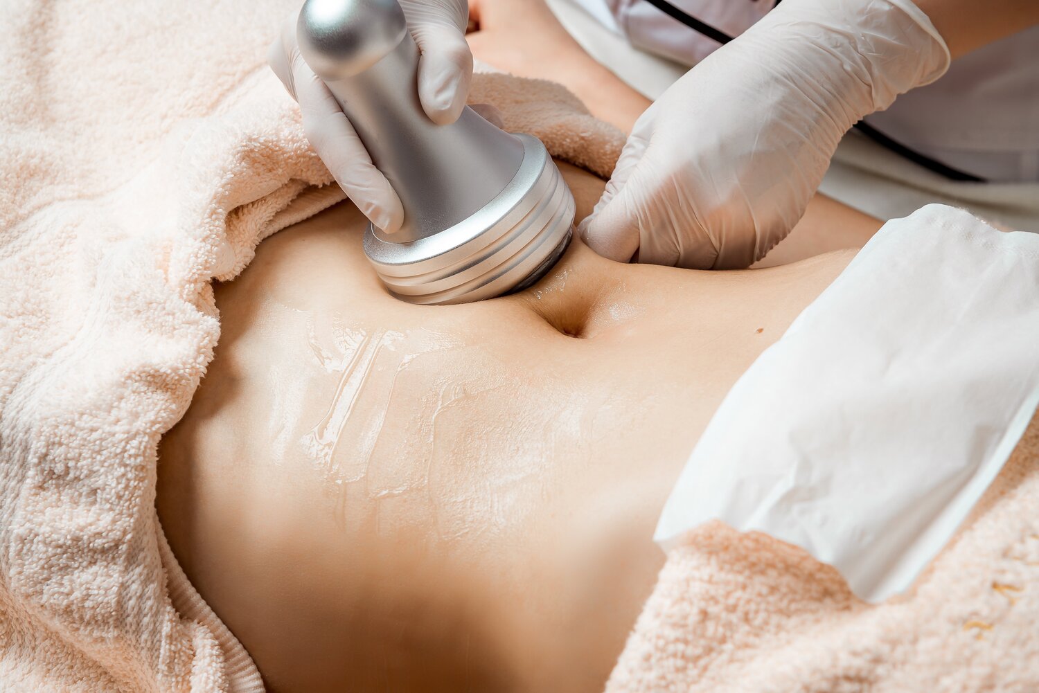 Body Cavitation Smoothing Treatment 1 Body Cavitation Smoothing Treatment