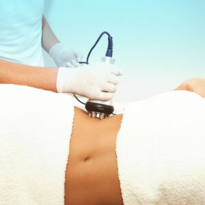 RF Body Contouring Treatment