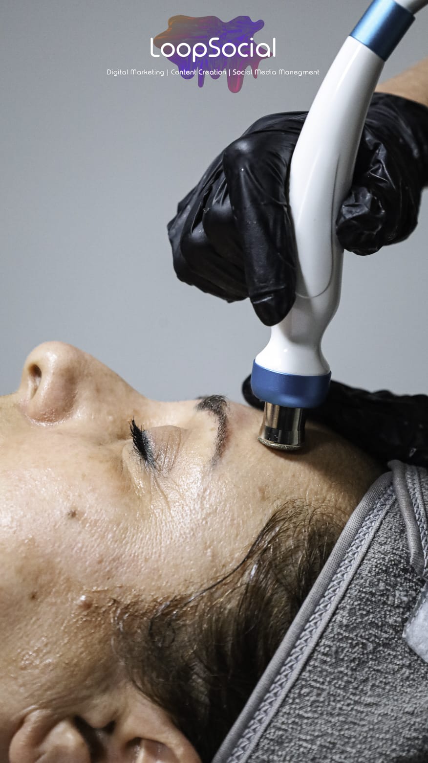 Microdermabrasion 1 Microdermabrasion