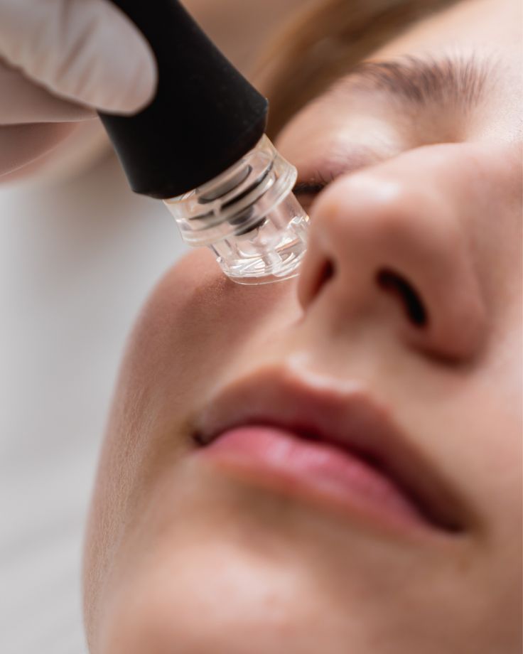 HydraFacial 1 HydraFacial